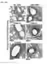 Fig. 23 - Microbial consortium and uses thereof