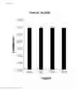 Fig. 06 - Composition for prevention, alleviation or treatment of precocious puberty containing extract of coicis semen and artemisia capillaris as active ingredient