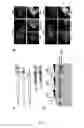 Fig. 09 - Polypeptides comprising vinculin binding sites for the treatment of proliferation and/or adhesion related diseases