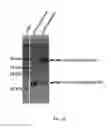 Fig. 16 - Polypeptides comprising vinculin binding sites for the treatment of proliferation and/or adhesion related diseases