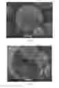 Fig. 14 - Pharmaceutical compositions of water soluble peptides with poor solubility in isotonic conditions and methods for their use