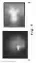 Fig. 06 - Use of a cyclic tripeptide for improving cellular energy metabolism