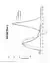 Fig. 04 - Erythropoietin for gastrointestinal dysfunction