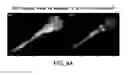 Fig. 06 - Motor neuron-specific expression vectors
