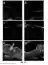 Fig. 08 - Method and apparatus for decellularization of tissue