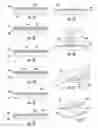 Fig. 03 - SYSTEMS AND METHODS FOR NEURAL DRUG DELIVERY AND MODULATION OF BRAIN ACTIVITY