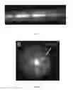 Fig. 07 - Injection device and methods related thereto