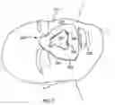 Fig. 07 - RESPIRATION MASK INTERFACE SEAL