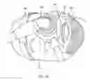 Fig. 09 - RESPIRATION MASK INTERFACE SEAL