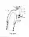 Fig. 89 - Vent adaptor for a respiratory therapy system