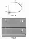 Fig. 04 - Hub for device placement with optical shape sensed guidewire