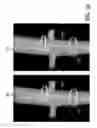 Fig. 09 - Hub for device placement with optical shape sensed guidewire