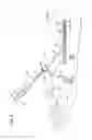 Fig. 04 - Treatment method using catheter assembly and catheter assembly