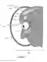Fig. 03 - METHOD AND APPARATUS FOR RAPID ASSESSMENT AND TREATMENT OF TRAUMATIC BRAIN INJURY