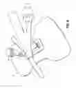 Fig. 05 - Securement device for medical devices