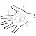 Fig. 11 - Securement device for medical devices