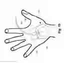 Fig. 12 - Securement device for medical devices