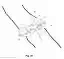 Fig. 20 - Securement device for medical devices