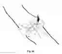 Fig. 23 - Securement device for medical devices