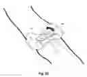 Fig. 24 - Securement device for medical devices