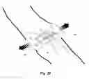 Fig. 25 - Securement device for medical devices
