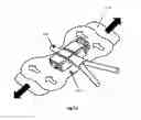Fig. 36 - Securement device for medical devices