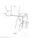 Fig. 08 - Interventional tool delivery devices, systems and methods