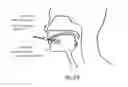 Fig. 28 - DEVICES AND METHODS FOR DELIVERING SUBTANCES FOR IMPROVED WELLBEING