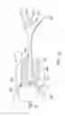 Fig. 03 - Minimally invasive methods for hemostasis in a bleeding closed tissue volume