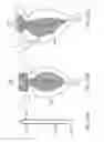Fig. 64 - Minimally invasive methods for hemostasis in a bleeding closed tissue volume