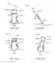 Fig. 80 - Minimally invasive methods for hemostasis in a bleeding closed tissue volume