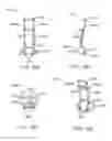 Fig. 82 - Minimally invasive methods for hemostasis in a bleeding closed tissue volume