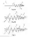 Fig. 03 - Neural electrodes and methods for implanting same