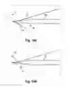 Fig. 10 - Neural electrodes and methods for implanting same