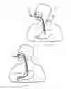 Fig. 03 - ACTIVATING MUSCLE CONTRACTIONS ALONG A GI TRACT PORTION
