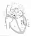 Fig. 01 - Systems and methods for treating cardiac arrhythmias