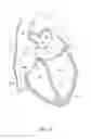Fig. 19 - Systems and methods for treating cardiac arrhythmias