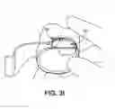 Fig. 05 - Adapter assemblies for implantable medical electrical systems
