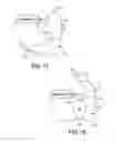 Fig. 20 - Adapter assemblies for implantable medical electrical systems