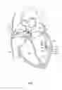 Fig. 02 - Systems and methods for treating cardiac arrhythmias