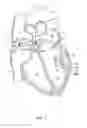 Fig. 02 - Systems and methods for treating cardiac arrhythmias