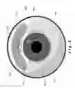 Fig. 06 - Ocular devices