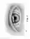 Fig. 08 - Ocular devices