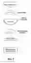 Fig. 02 - Breast Cup System and Method for Hyperthermic Anaerobic Cell Apoptosis