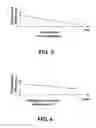 Fig. 04 - Breast Cup System and Method for Hyperthermic Anaerobic Cell Apoptosis