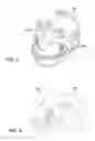 Fig. 06 - Padding assembly
