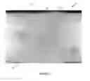 Fig. 02 - LOW DEFORMATION FILTER MEDIA