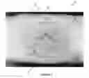 Fig. 03 - LOW DEFORMATION FILTER MEDIA