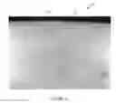 Fig. 05 - LOW DEFORMATION FILTER MEDIA