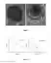 Fig. 06 - SiO-layered double hydroxide microspheres and methods of making them